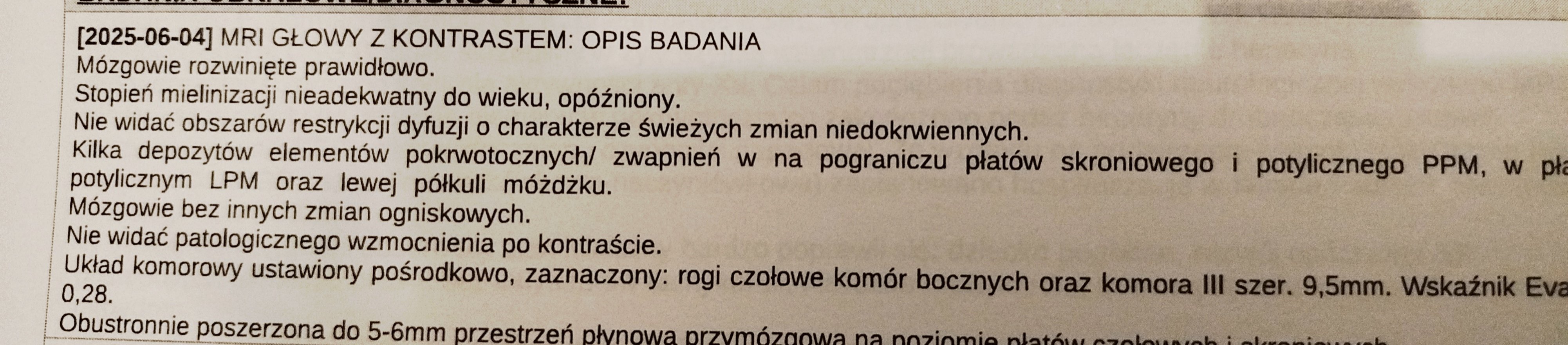 jvUopvWNIs1R9TeB.jpg