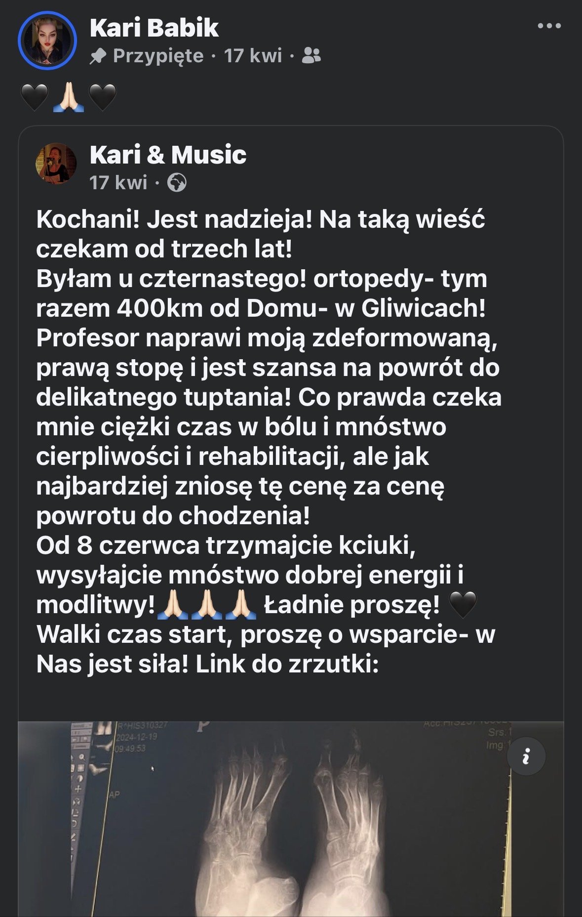 bAdyYm0XbwbOEh7J.jpg