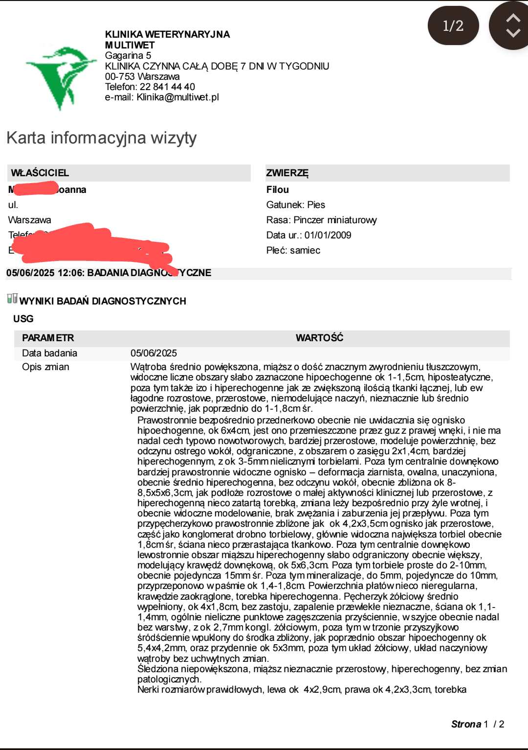NZXko6Jm1ouWVlEP.png